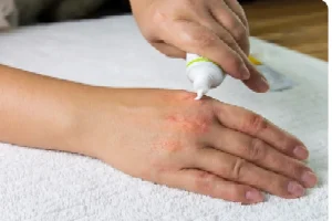 Find Out What Actually Causes Eczema