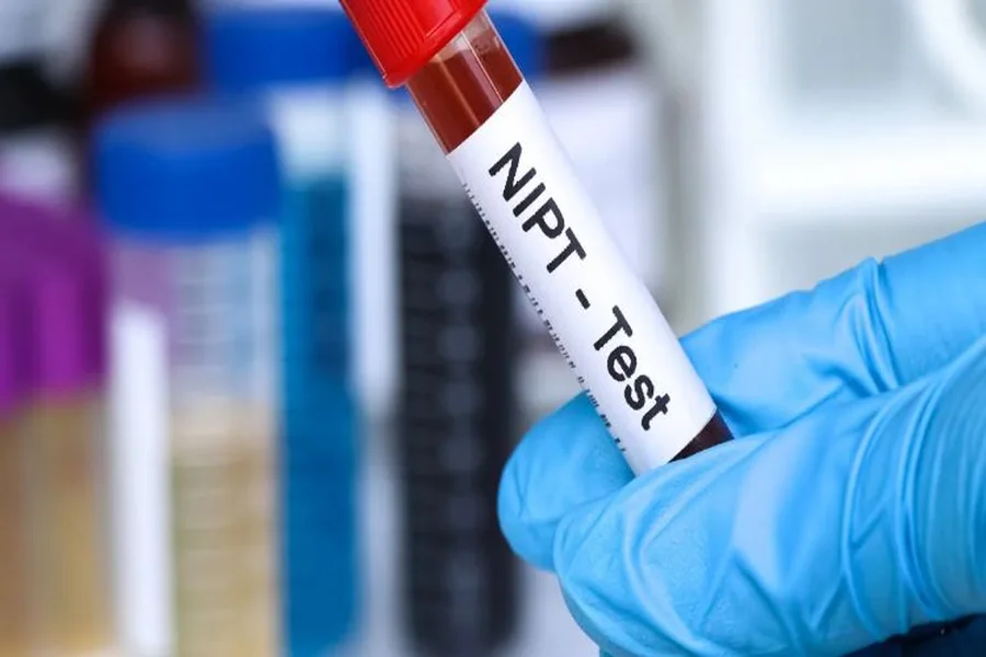Nipt Test Results